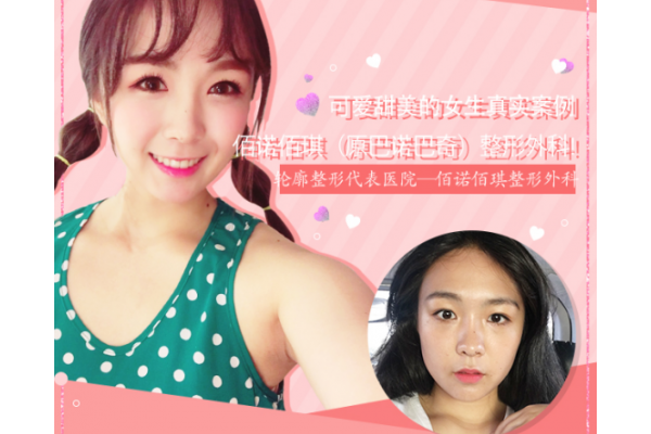 一次韩国面部轮廓手术就能获得真正意义上的效果性改善，恐怕也只有佰诺佰琪了！ ...